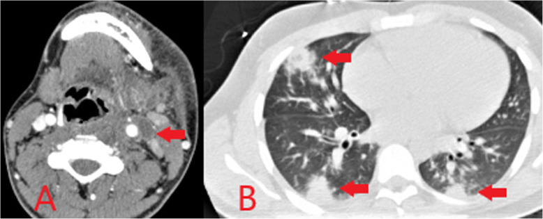 Fig. 21