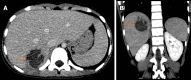 Figure 21