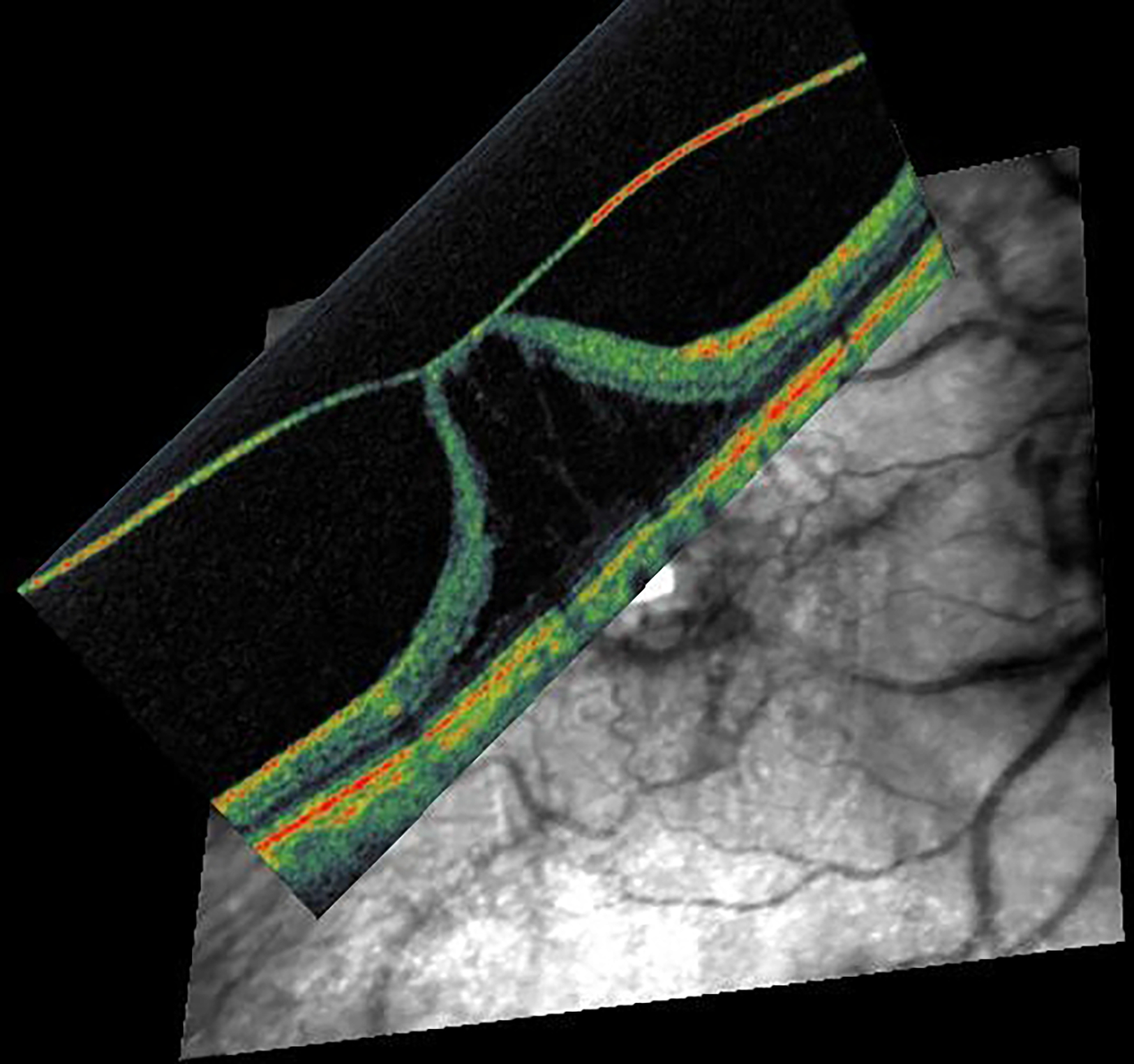 Figure 10: