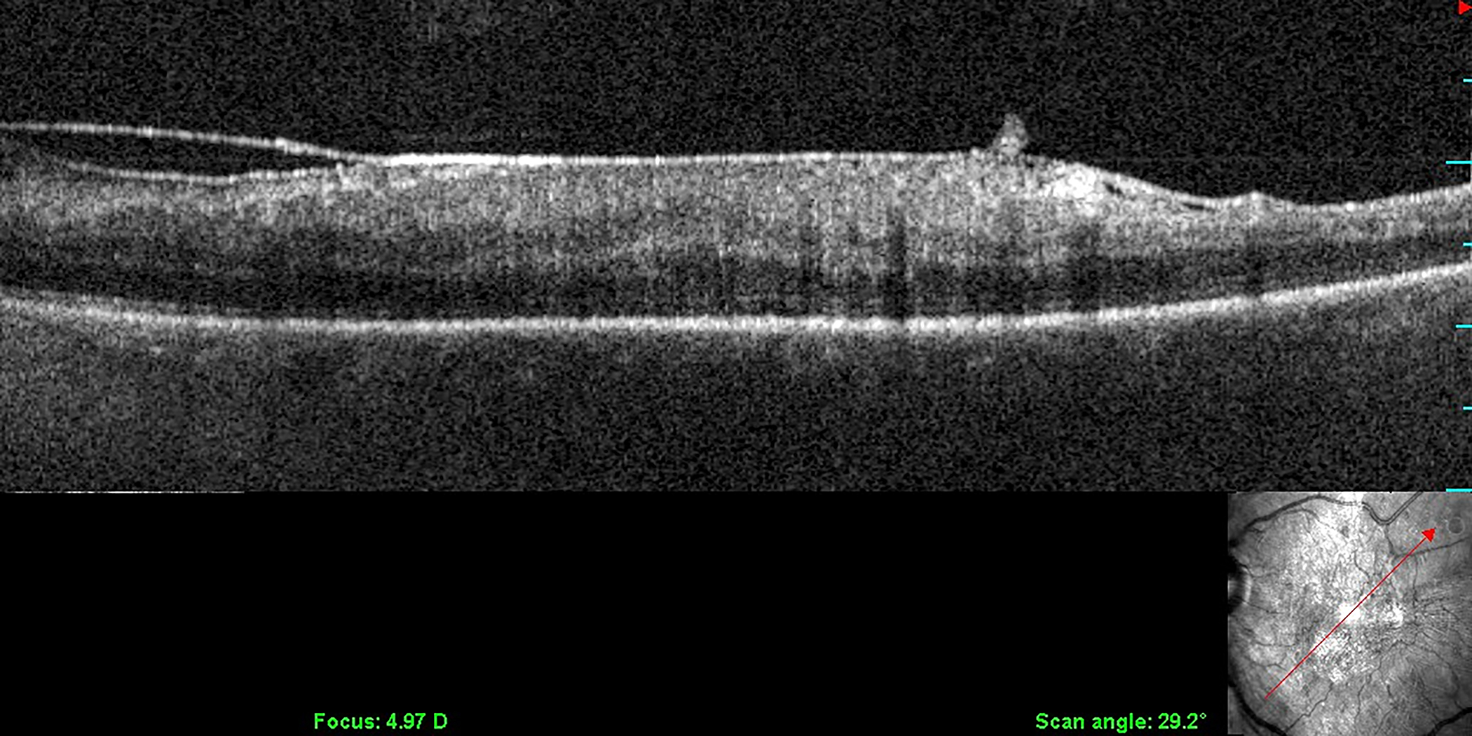 Figure 2: