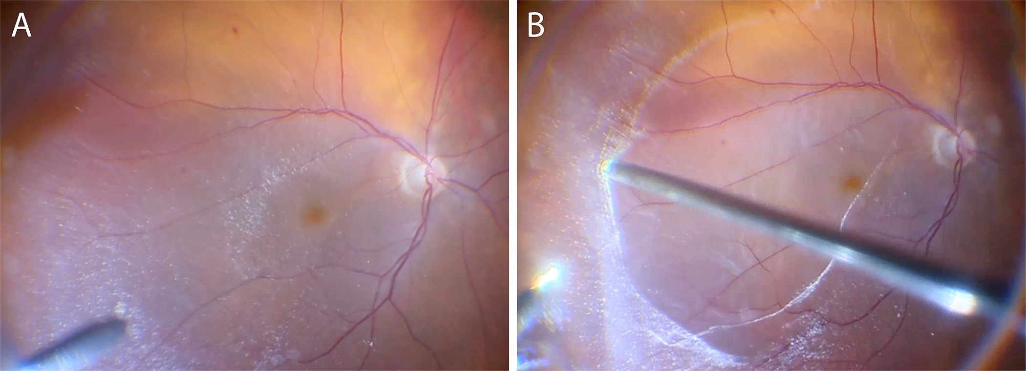 Figure 13: