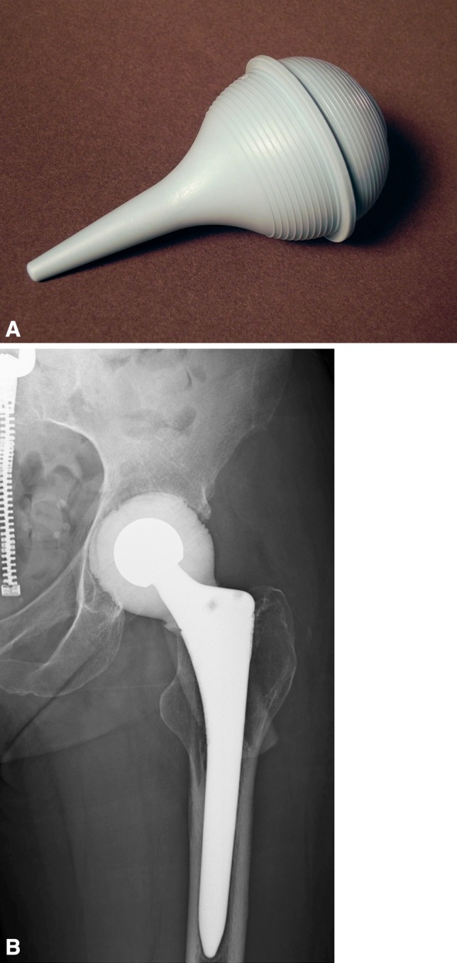 Fig. 1A–B