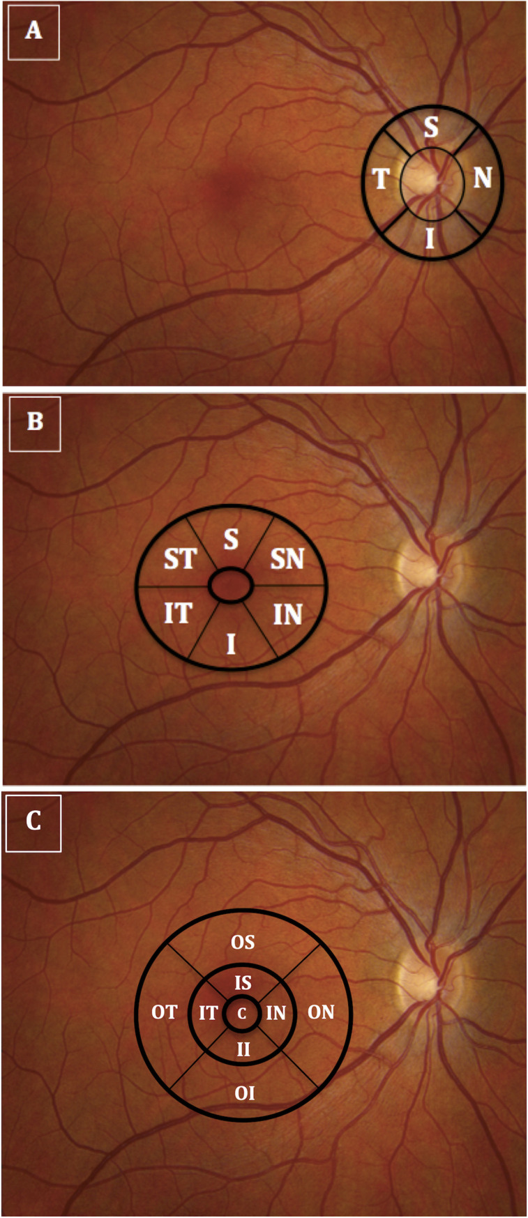 Fig 1