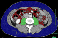 graphic file with name TCA-13-549-g002.jpg