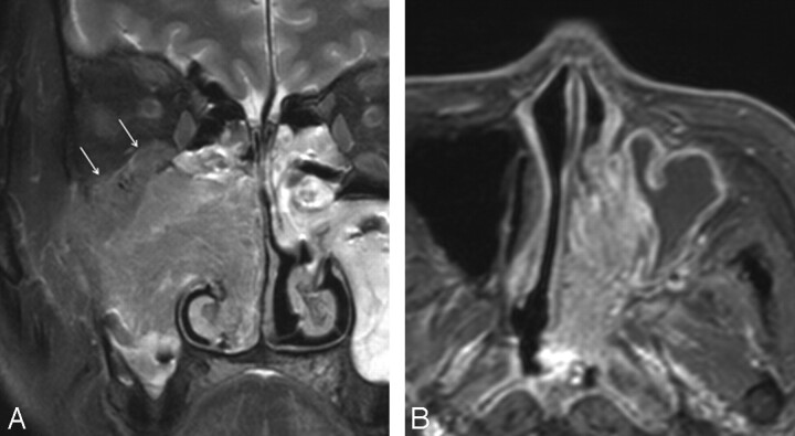 Fig 2.