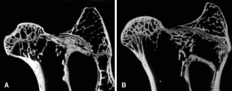 Fig. 2A–B