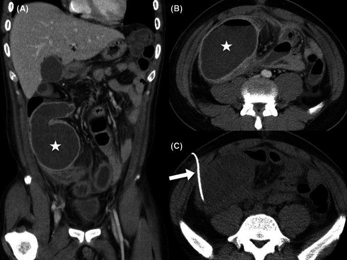 FIGURE 2