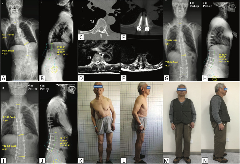 Fig. 4