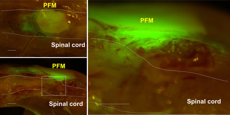 Fig 3