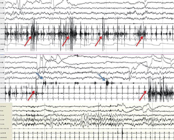 FIGURE 1