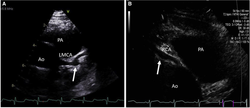 Figure 2