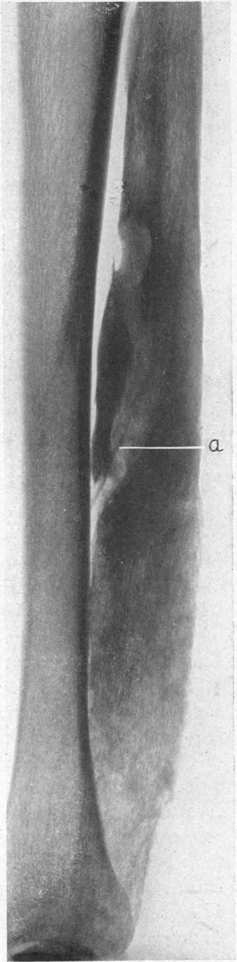 FIG. 11.