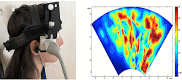 The typical set-up of the TPI equipment on a participant, with measurements taken from the right temporal position (left).