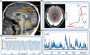 Illustrations of representative dynamic MRI techniques for capturing neurofluid pulsations, including dynamic diffusion-weighted imaging (dynDWI) for assessing the CSF pulsations in the perivascular subarachnoid space; functional MRI (fMRI) for capturing CSF inflow at the 4th ventricle; real-time and 4D phase-contrast (PC) MRI for quantitatively measuring CSF flow at the C2/C3 level or the aqueduct; and balanced SSFP for semi-quantitatively measuring CSF flow along the ventricles and spinal canal