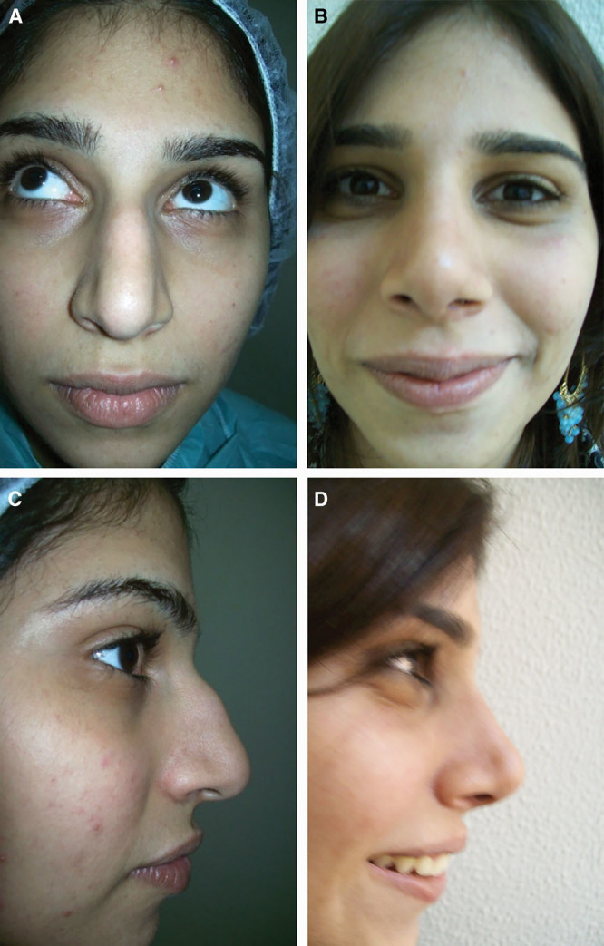 Fig. 4.