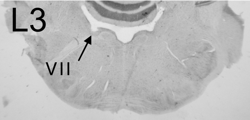 FIG. 11.