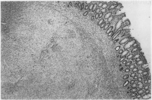 graphic file with name jclinpath00418-0080-b.jpg