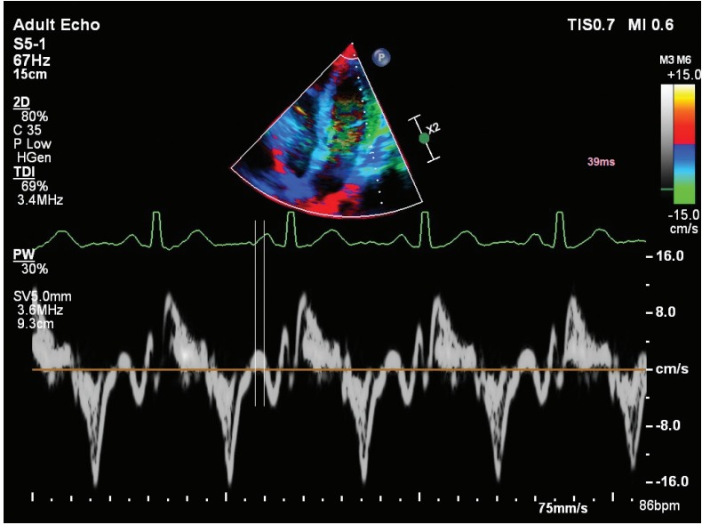 Figure 2.