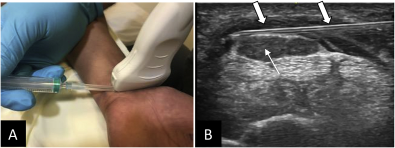 Fig. 6