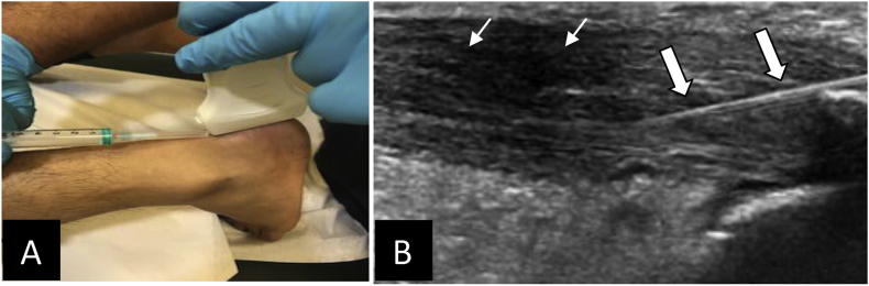 Fig. 2