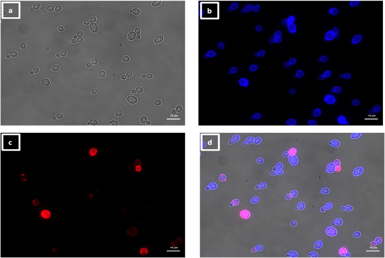 Four microscopy images depict cells under different conditions: brightfield, colored fluorescence, and a merged image combining the channels. Merged image highlights cells with overlapping fluorescence signals.