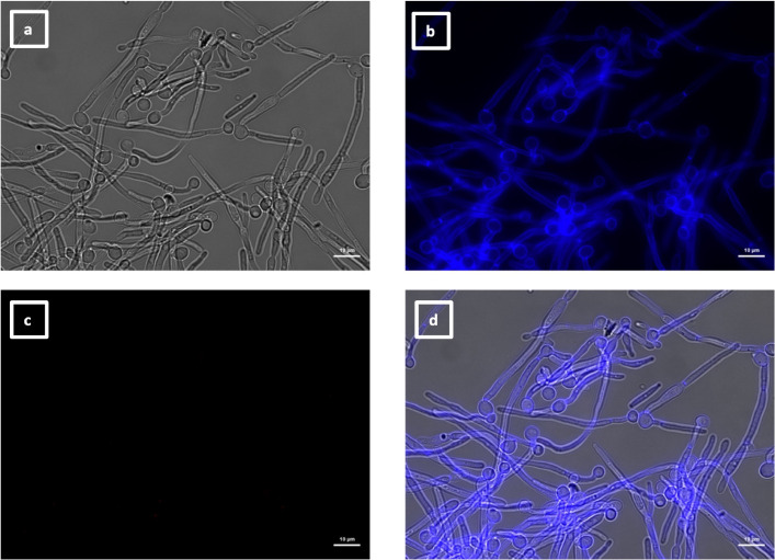 Four microscopy images showing brightfield or fluorescent images of calcofluor white stained hyphae of als3 mutant with no binding of VHH14 to the mutant hyphae.