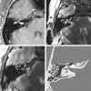 <sc>fig</sc> 3.