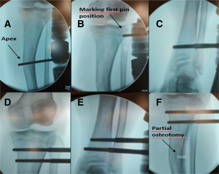 Fig 2