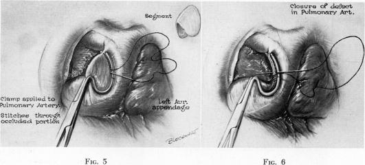 Fig. 5., Fig. 6.