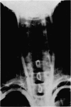 474-3