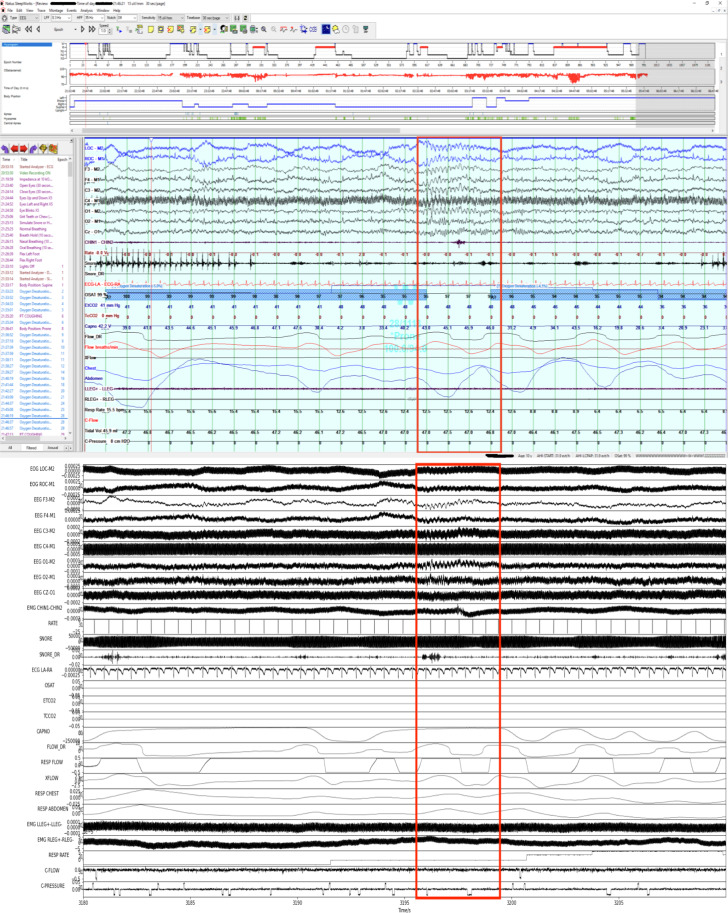 Fig. 3