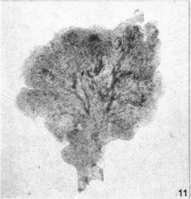 Fig. 11