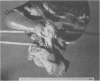 44