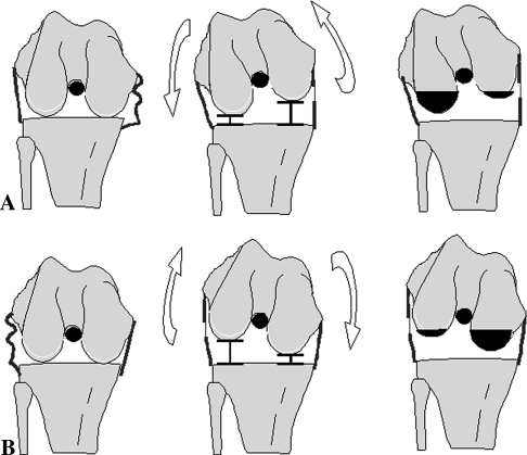 Fig. 1A–B