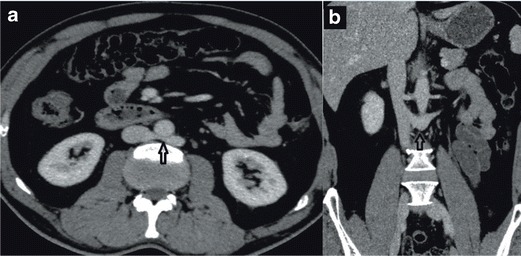 Fig. 13