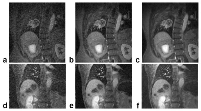 FIG. 10