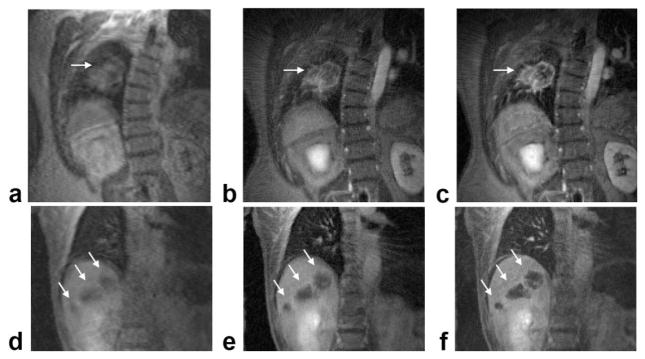 FIG. 6