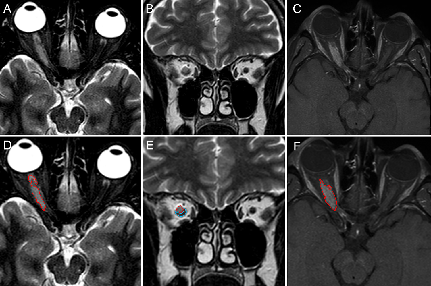 Figure 2 -