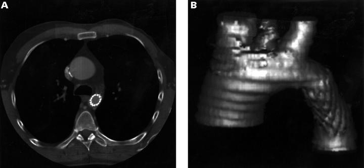 Figure 2  