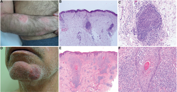 Fig. 1