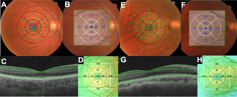 Fig. 1