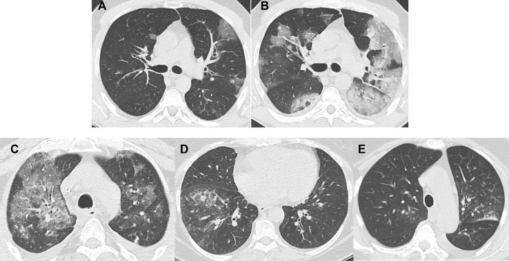 Fig. 1