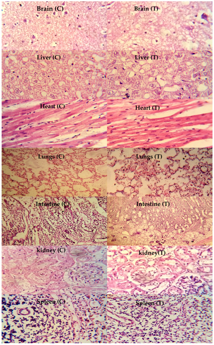 Figure 11