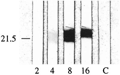 Species-Specific Serodiagnosis Of Lyme Arthritis And Neuroborreliosis ...