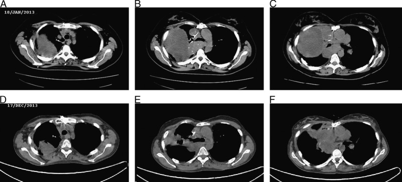 FIGURE 3