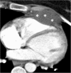 Fig. 17