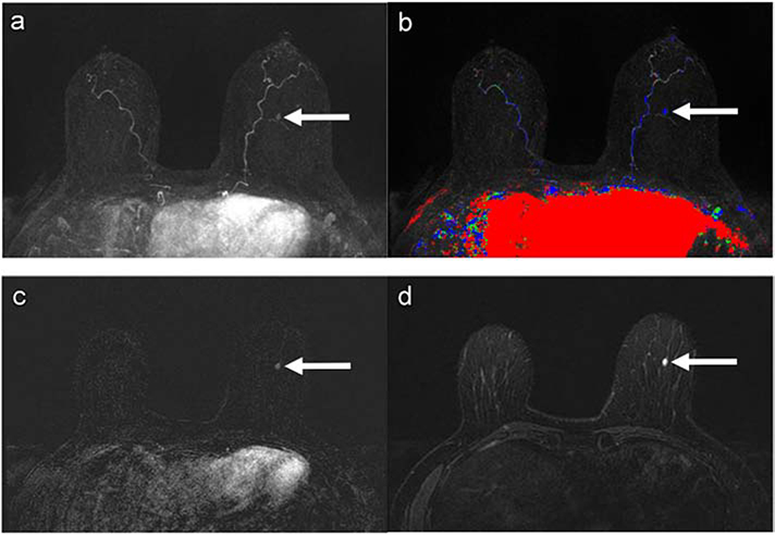 Figure 4: