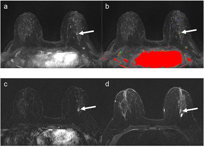 Figure 3: