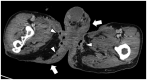 Fig. 12