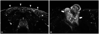 Fig. 13